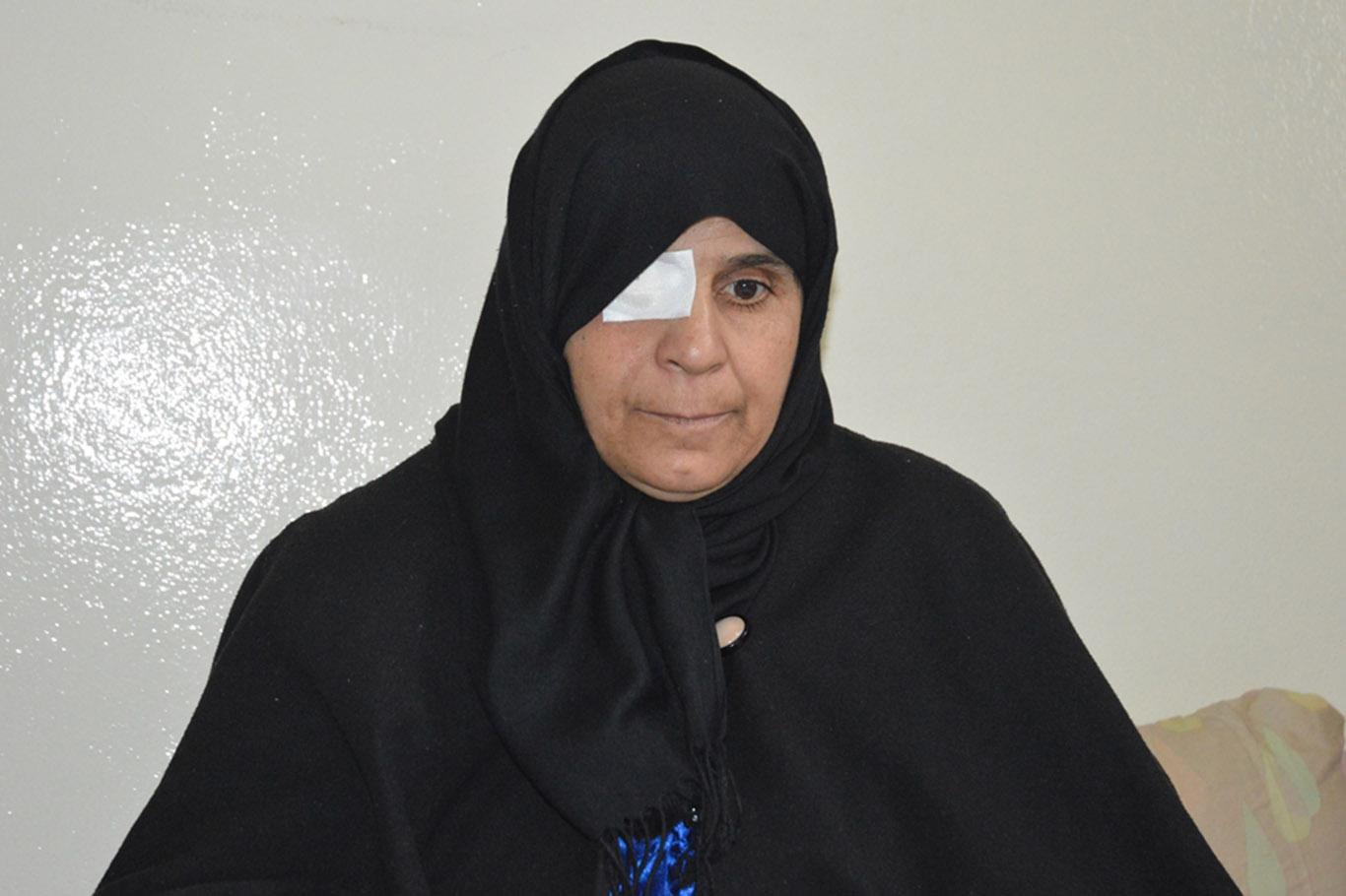 Suriyeli kadın ikinci gözünü de kaybetmek istemiyor Suriyeli kadın ikinci gözünü de kaybetmek istemiyor